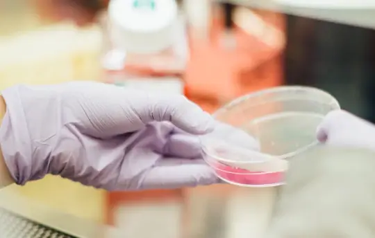 A healthcare researcher examining a pink fluid in a Petri dish.